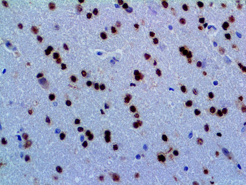 OLIG2 – RMab