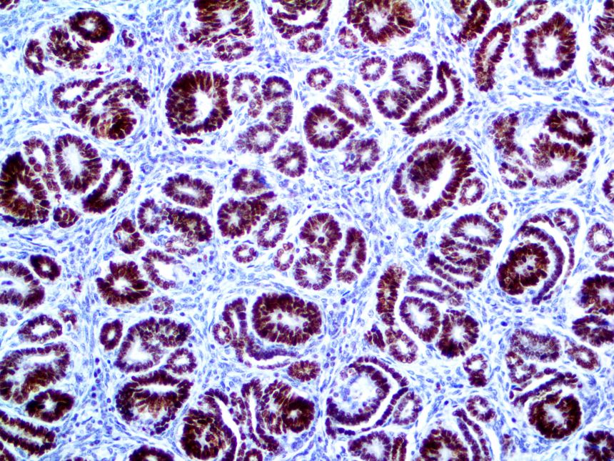 PAX-2 – RMab