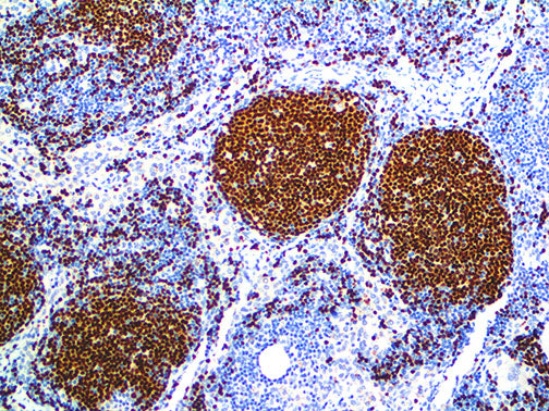 PAX-5 – RMab