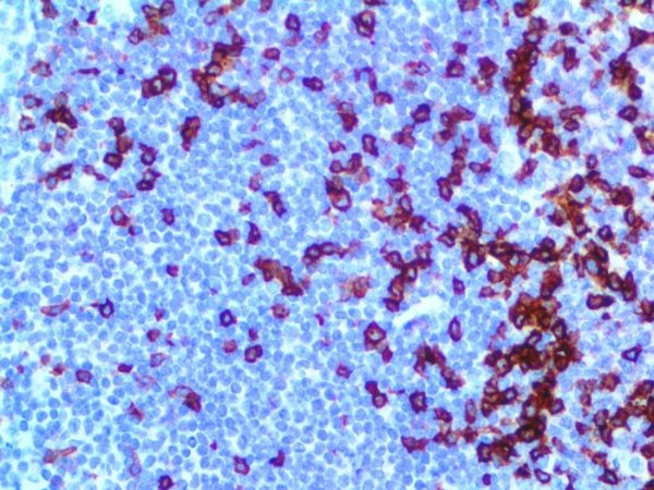 PD-1/CD279 – MMab