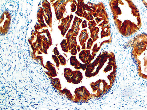 PSMA – RMab