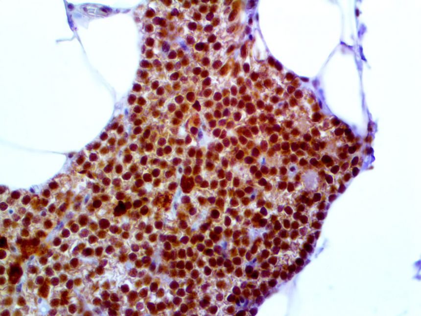 Parafibromin – MMab