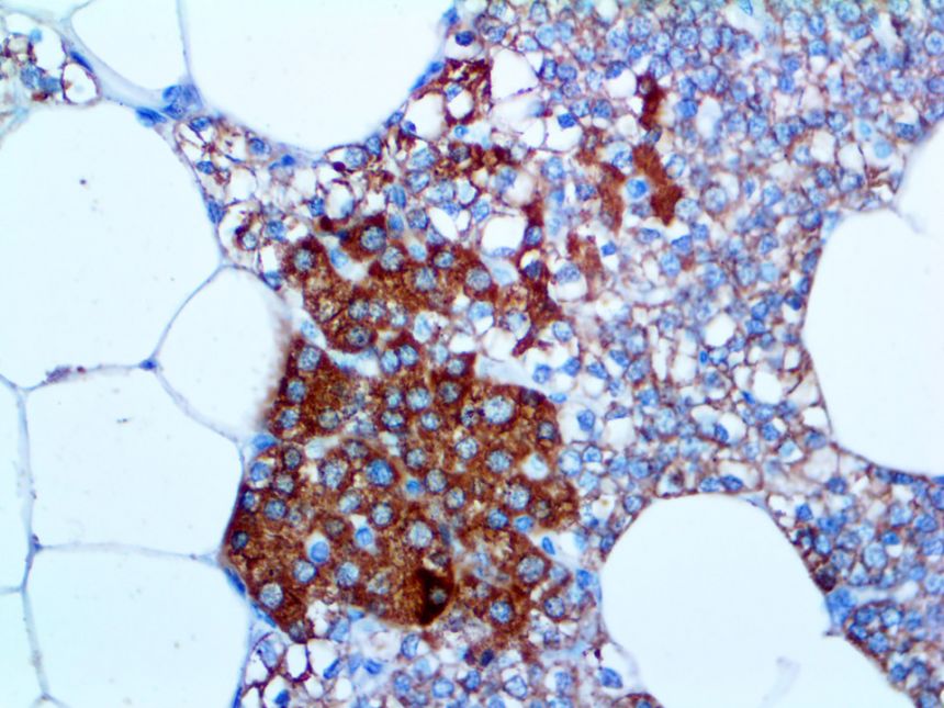 Parathyroid (PTH) – MMab