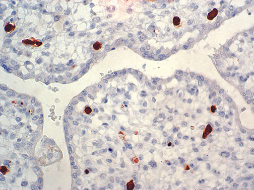 Parvovirus – MMab