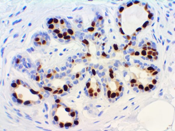 Progesterone Receptor – MMab