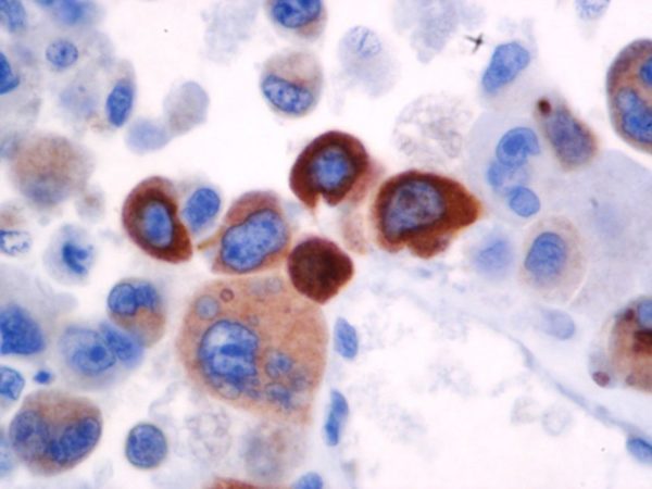 Prolactin – RMab