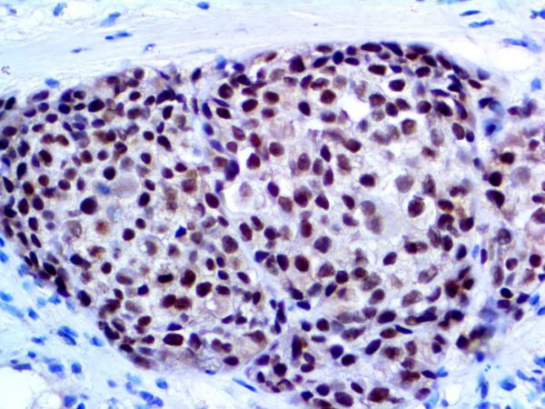 SOX-10 – RMab