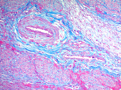 Trichrome Stain Kit (Modified Gomori's)