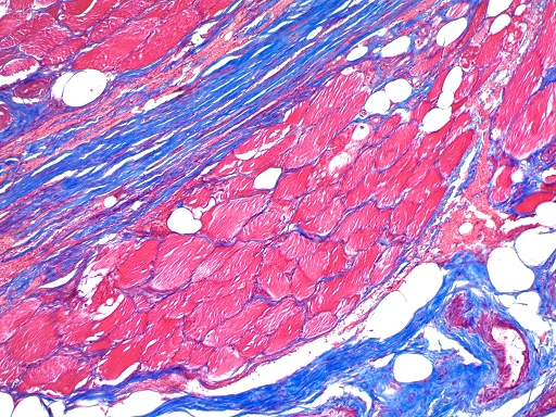 Trichrome Stain Kit (Modified Masson's)