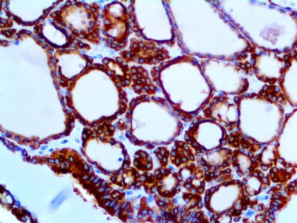 Thyroid Peroxidase – RMab