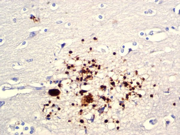 Toxoplasma gondii – Rabbit Polyclonal