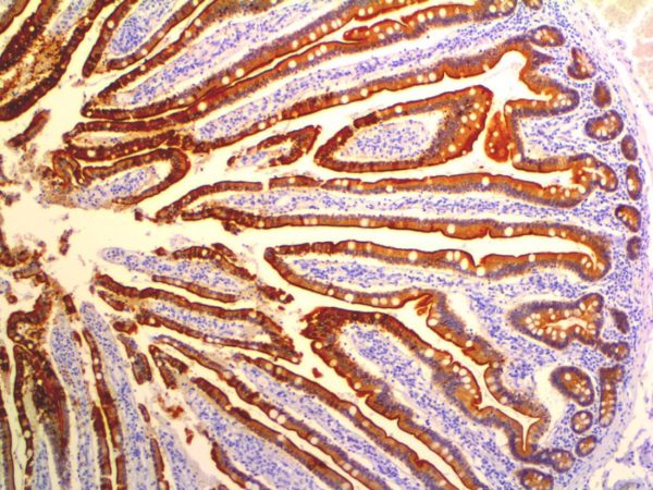 Vimentin – MMab