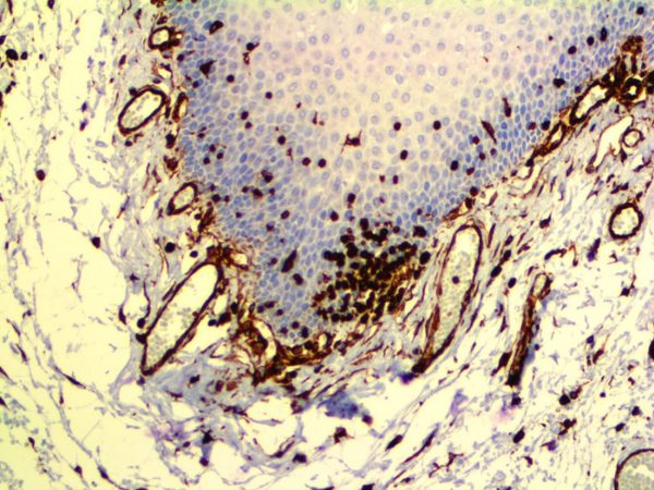 Vimentin – MMab