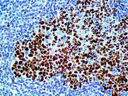 bcl6 – MMab