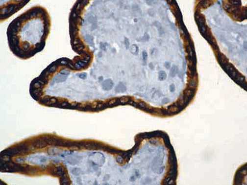 hCG – MMab