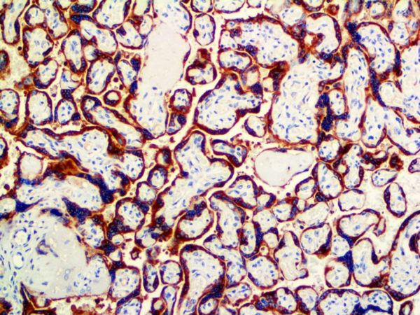 hPL – Rabbit Polyclonal