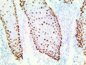 Mohs PolyDetector Plus DAB HRP Brown Detection System