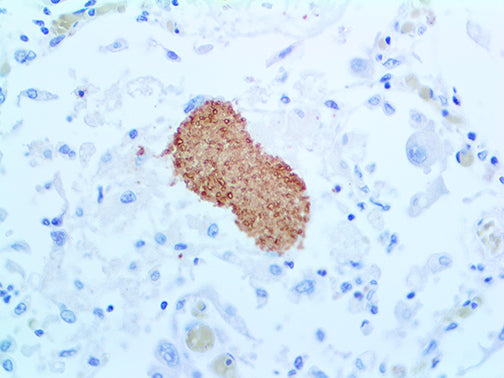 Pneumocystis Jirovecii – MMab